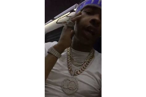 Lil Baby Raps About Police Causing Bruises On His Face Xxl