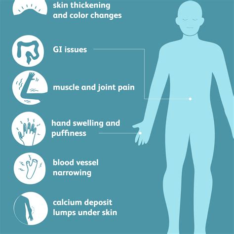 Scleroderma Signs Symptoms And Complications