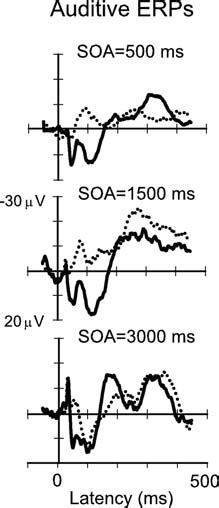 Auditory Event Related Potentials Erps Grand Averaged Responses To