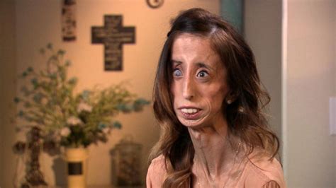 Lizzie Velasquez On Turning A Life Of Bullying Into Powerful Motivation