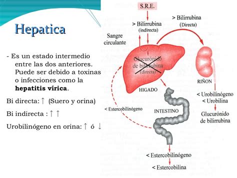 Infecciones Hepáticas Ictericia Obstructiva