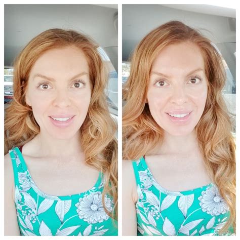 Grace D Plunk Massage Envy Chemical Peel Review And Before And After Pictures