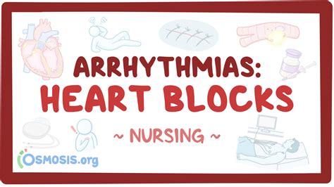 Arrhythmias Heart Blocks Nursing Osmosis Video Library