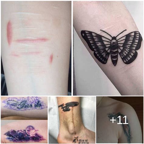 Amazing Tattoos That Turn Scars Into Works Of Art