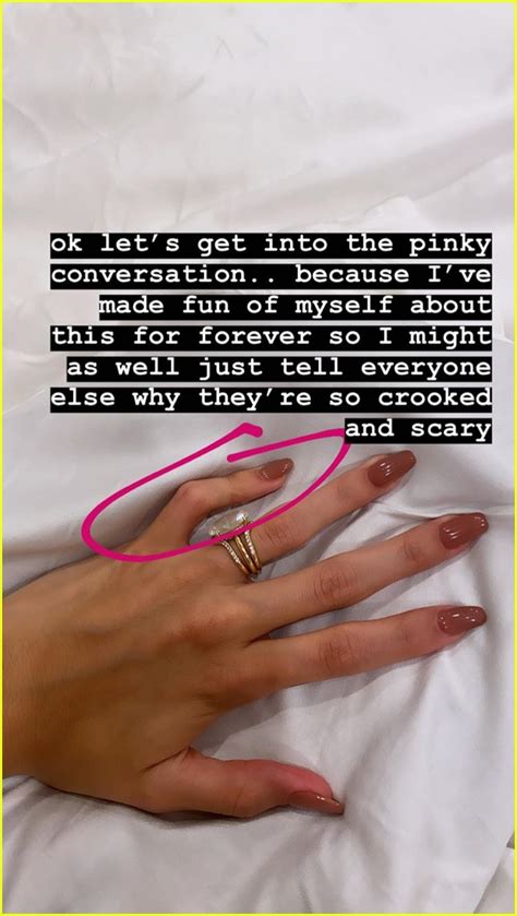 Hailey Bieber Is Explaining Why Her Pinky Fingers Are So Crooked And Scary Photo 4425669