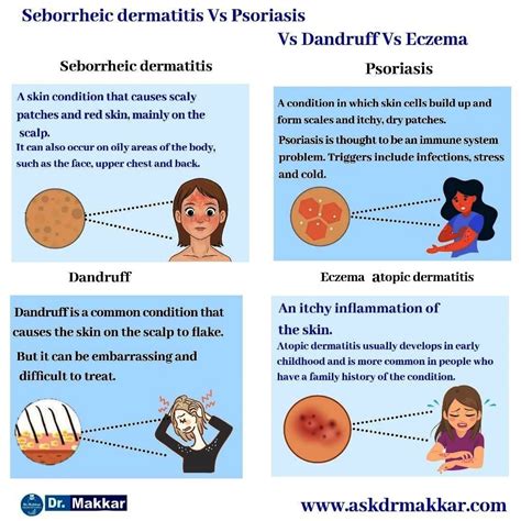 Difference Between Eczema And Seborrheic Dermatitis
