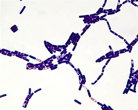 Bacillus Species Gram Stain Etsy