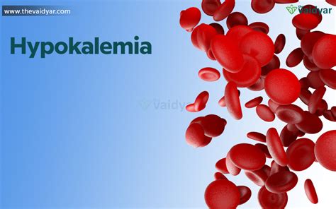 Hypokalemia And Hyperkalemia Major Signs And Causes