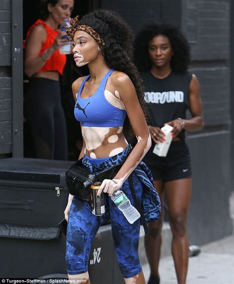 Winnie Harlow Flaunts Herd Abs In A Crop Top And Stylish Gym Wear