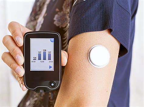 La réalisation d'un test par. 'Real-world' Benefit Shown for FreeStyle Libre Glucose Monitor