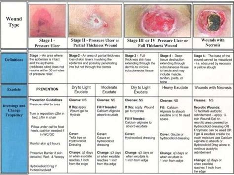 Stage Pressure Ulcer Buttocks Pictures To Pin On Pinterest Pinsdaddy
