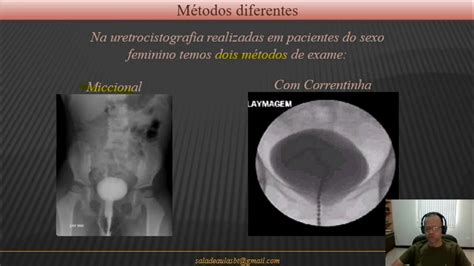 Exames RadiolÓgicos Especiais Uretrocistografia Miccional VÍdeo 88