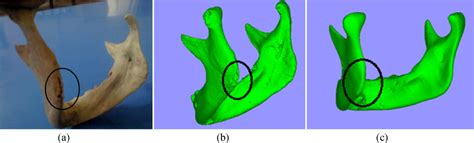 Destroyed Edge In A Dry Mandible B Initial Stl Model C