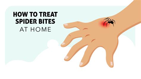 How Do I Treat A Spider Bite At Home Pest Phobia