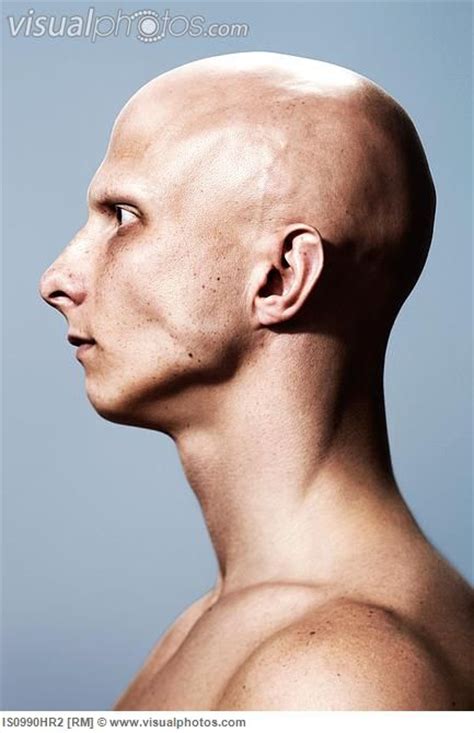 A Side View Of A Bald Man Handy For Getting The Shape Of The Mans