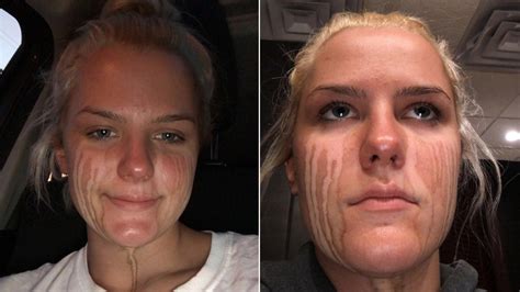 Teen Proves Crying After Spray Tan Leads To Streaks In Viral Tweet Allure