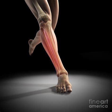 Medial Tibial Stress Syndrome Photograph By Science Picture Co