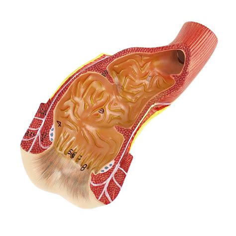 Buy Human Rectal Model Anal Canal Anatomy Model Anorectal Surgery