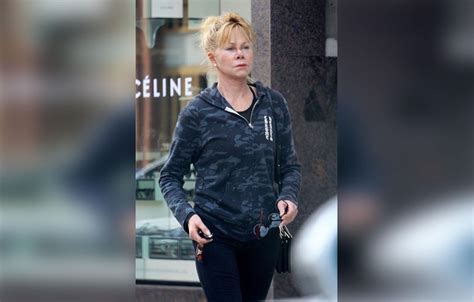 Melanie Griffith Wears Nose Bandage After Skin Cancer Treatment