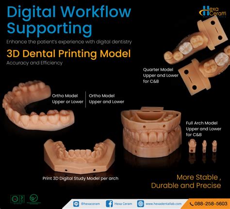 3d Dental Printing Model Hexa Ceram Dental Lab