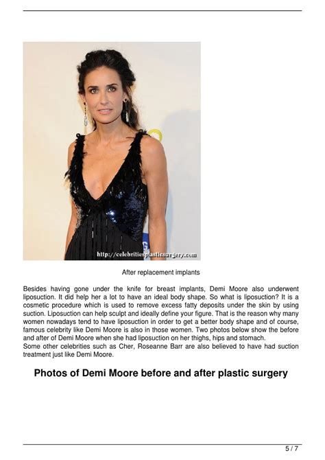 Demi Moore Plastic Surgery Before And After Photos By Plastic Surgery