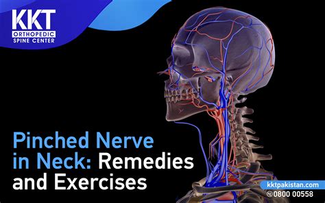 Pinched Nerve In Neck Remedies And Exercises Testingform