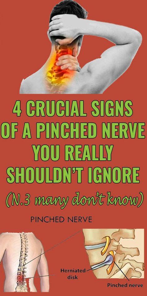 4 Crucial Signs Of A Pinched Nerve You Really Shouldt Ignore With