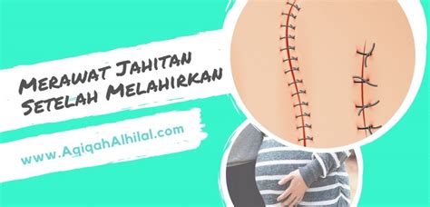 Tips Merawat Jahitan Setelah Melahirkan Agar Lekas Sembuh Aqiqah