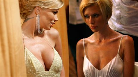 Before After Breast Implants Nude Free Porn My Xxx Hot Girl