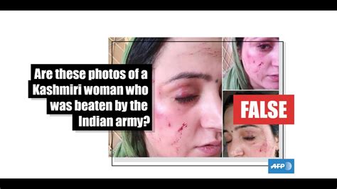 No This Is Not A Photo Of A Kashmiri Woman Beaten By The Indian Army Fact Check