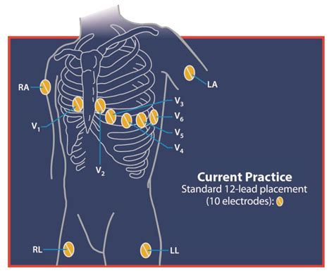 Electrocardiogram With 15 Leads Including The Interpretation And Report