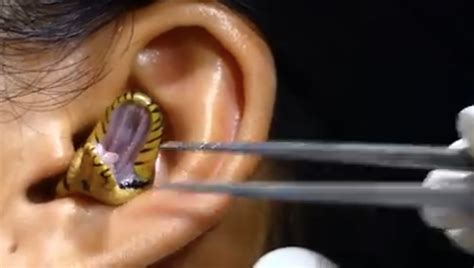 Snake Stuck In Woman S Ear Refuses To Come Out Watch This OutKick