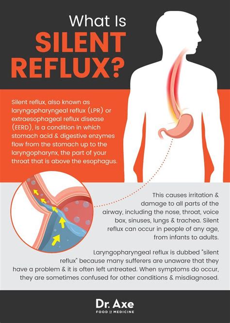 Silent Reflux Relieve Symptoms Naturally Reflux Disease Silent