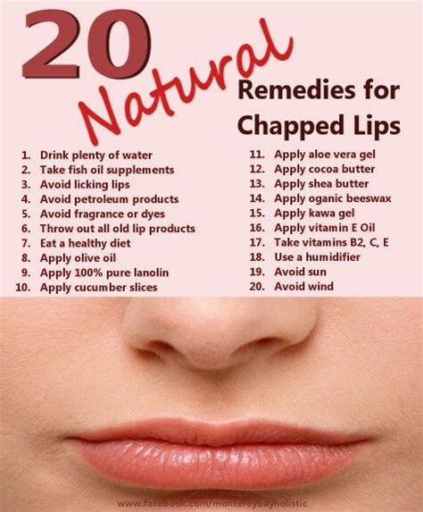 Natural Remedies For Dry Lips Dry Lips Remedy Chapped Lips Remedy