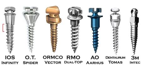 Ios Ortho The Use Of Temporary Anchorage Devices Tads Mini Implants