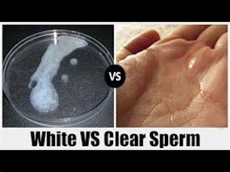 Difference Between White Sperm And Clear Sperm Difference Wiki