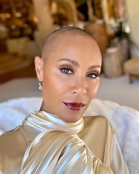 Jada Pinkett Smith Celebrates Her Alopecia Related Hair Loss Journey
