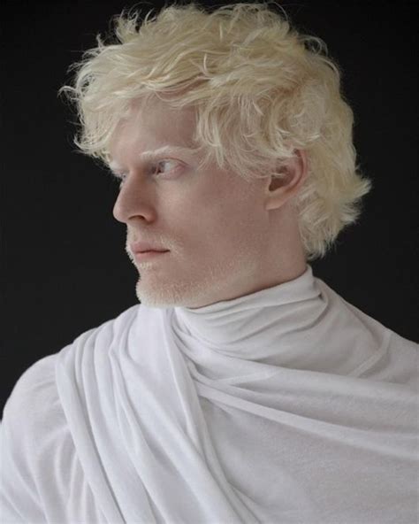 Pin By Julia Lee On Fashion Mood Albino Human Albino Model Stephen