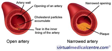 Veins and arteries diagram 205 circulatory pathways anatomy and physiology. Cholesterol Health - Calabrian Citrus Bergamot - Buy ...