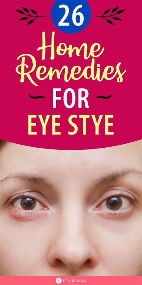 How To Get Rid Of A Stye 26 Home Remedies And Precautions Eye Stye