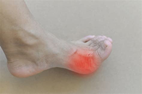 Some Common Causes Of Pain In The Big Toe Joint