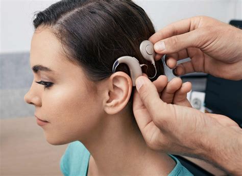 Cochlea Implantat Aufbau Kosten And Operation
