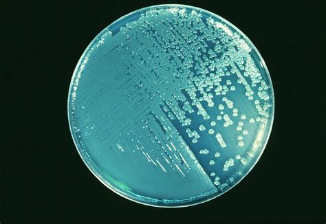 Cultured Pseudomonas Bacteria Photograph By Cnriscience Photo Library