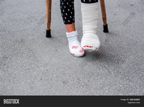 Little Girl Crutches Image And Photo Free Trial Bigstock