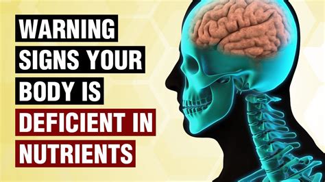 10 Warning Signs Your Body Is Deficient In Nutrients Youtube