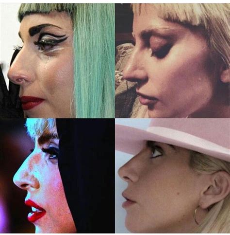 Before And After Surgery Lady Gaga Lady Gaga Nose Lady Gaga Nails Lady Gaga Plastic Surgery