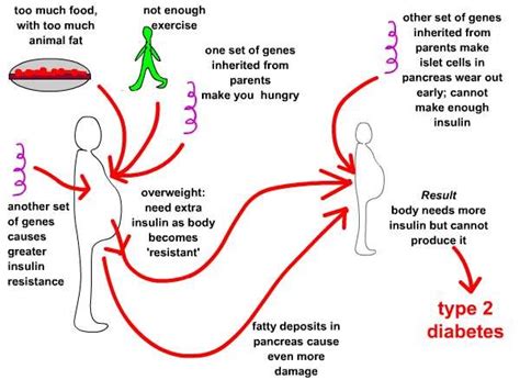 Chronic Diseases And Obesity Causes Of Diabetes Symptoms Diagnosis And Latest Treatment Of Type