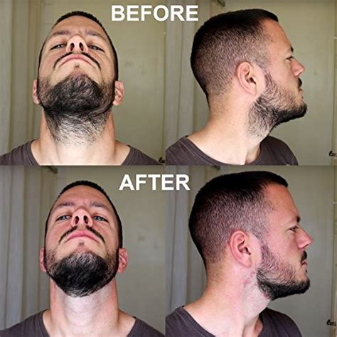 Aberlite Flexshaper Beard Shaper Neckline Guide Hands Free