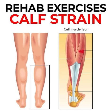 3 CALF STRAIN REHAB EXERCISES The Calf Muscle Consist Of The