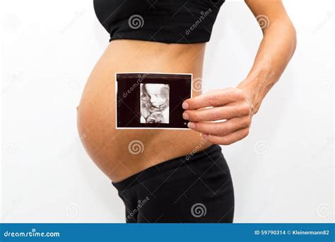 Pregnant Woman Holding An X Ray Stock Photo Image Of Ultrasound Love